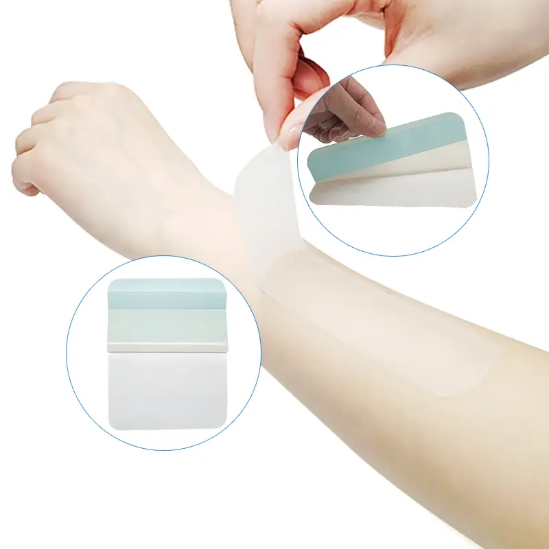 The Battle of Fluid Management for Burn Wounds: How to Resolve the Dilemma Between Exudate Control and Wound Healing?