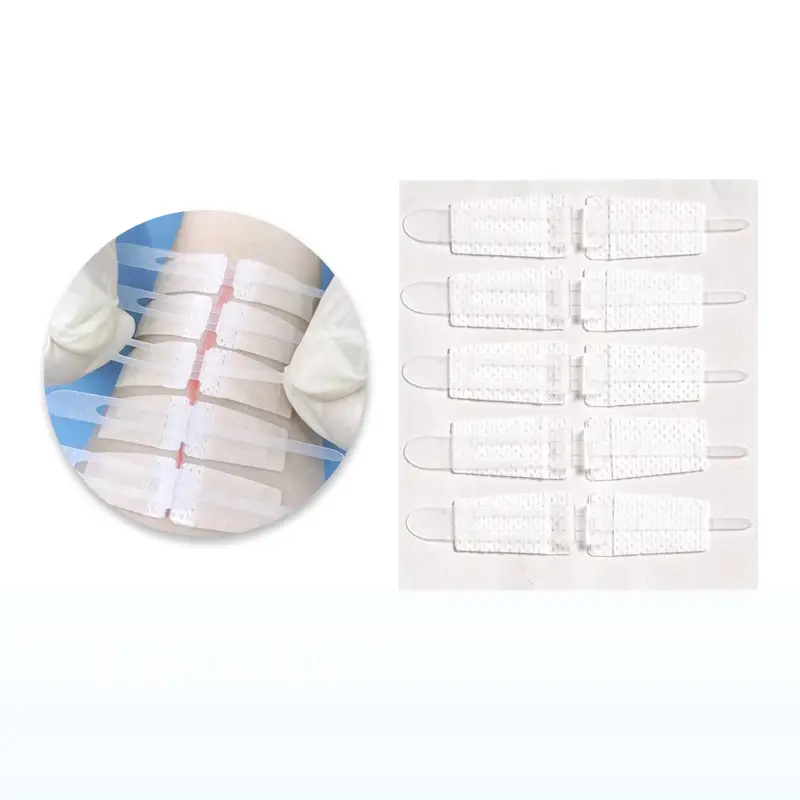 Top 3 Wound Closure Device Manufacturers In the USA
